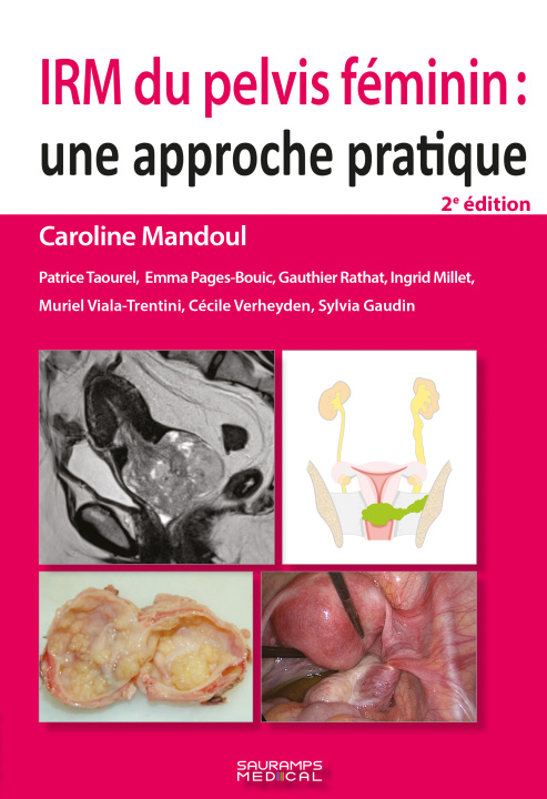 Kniha IRM du pelvis féminin 2e ED TAOUREL