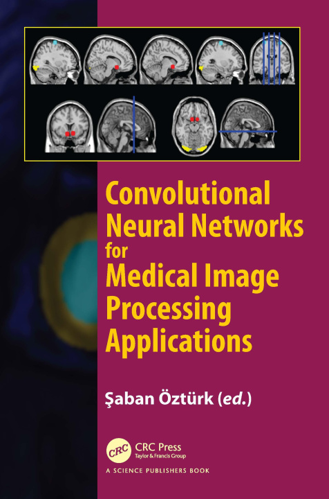 Carte Convolutional Neural Networks for Medical Image Processing Applications 