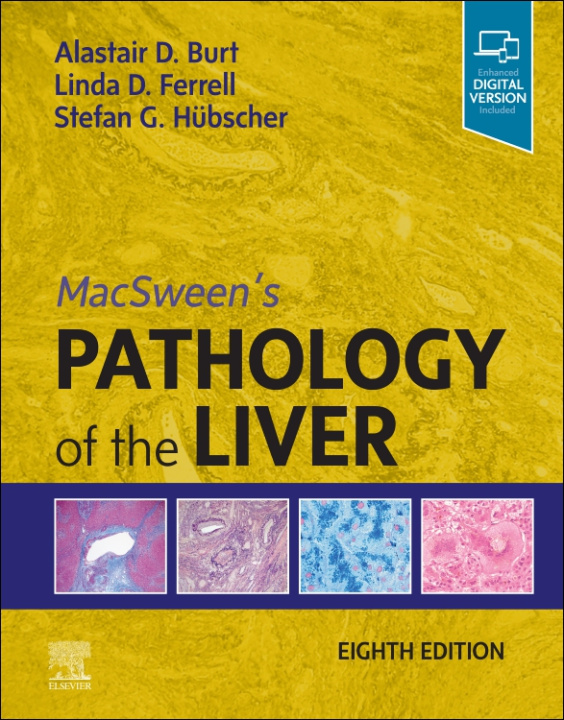 Könyv MacSween's Pathology of the Liver Alastair D. Burt