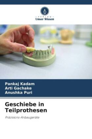 Book Geschiebe in Teilprothesen Arti Gachake