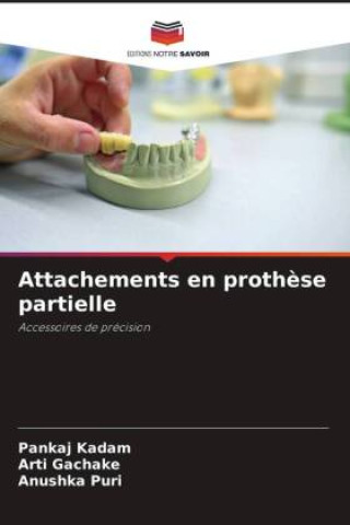 Book Attachements en proth?se partielle Arti Gachake