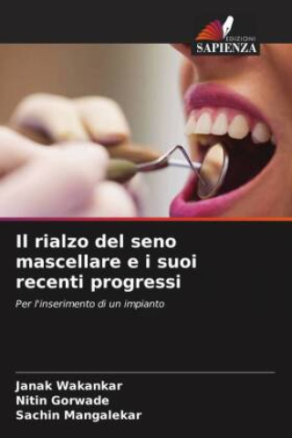 Book Il rialzo del seno mascellare e i suoi recenti progressi Nitin Gorwade