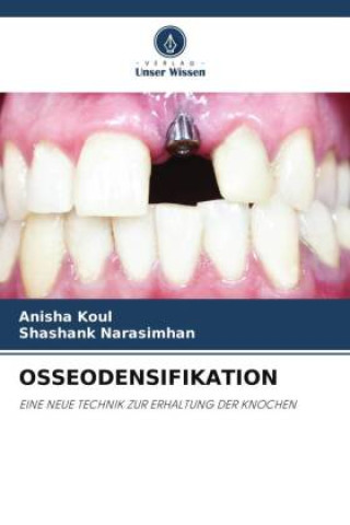 Buch OSSEODENSIFIKATION Shashank Narasimhan