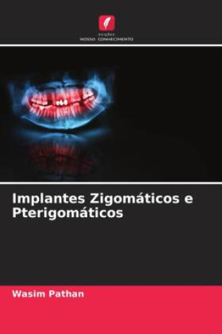 Knjiga Implantes Zigomáticos e Pterigomáticos Wasim Pathan