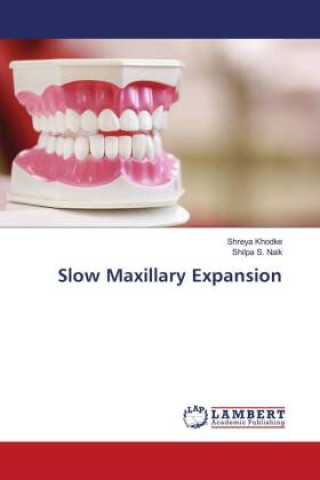 Knjiga Slow Maxillary Expansion Shilpa S. Naik