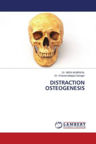 Knjiga DISTRACTION OSTEOGENESIS Chanamallappa Ganiger