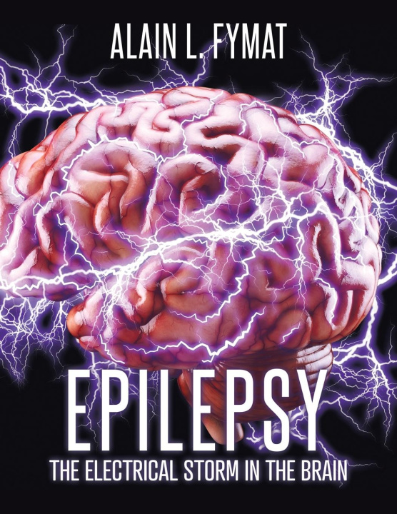Book Epilepsy Alain L Fymat