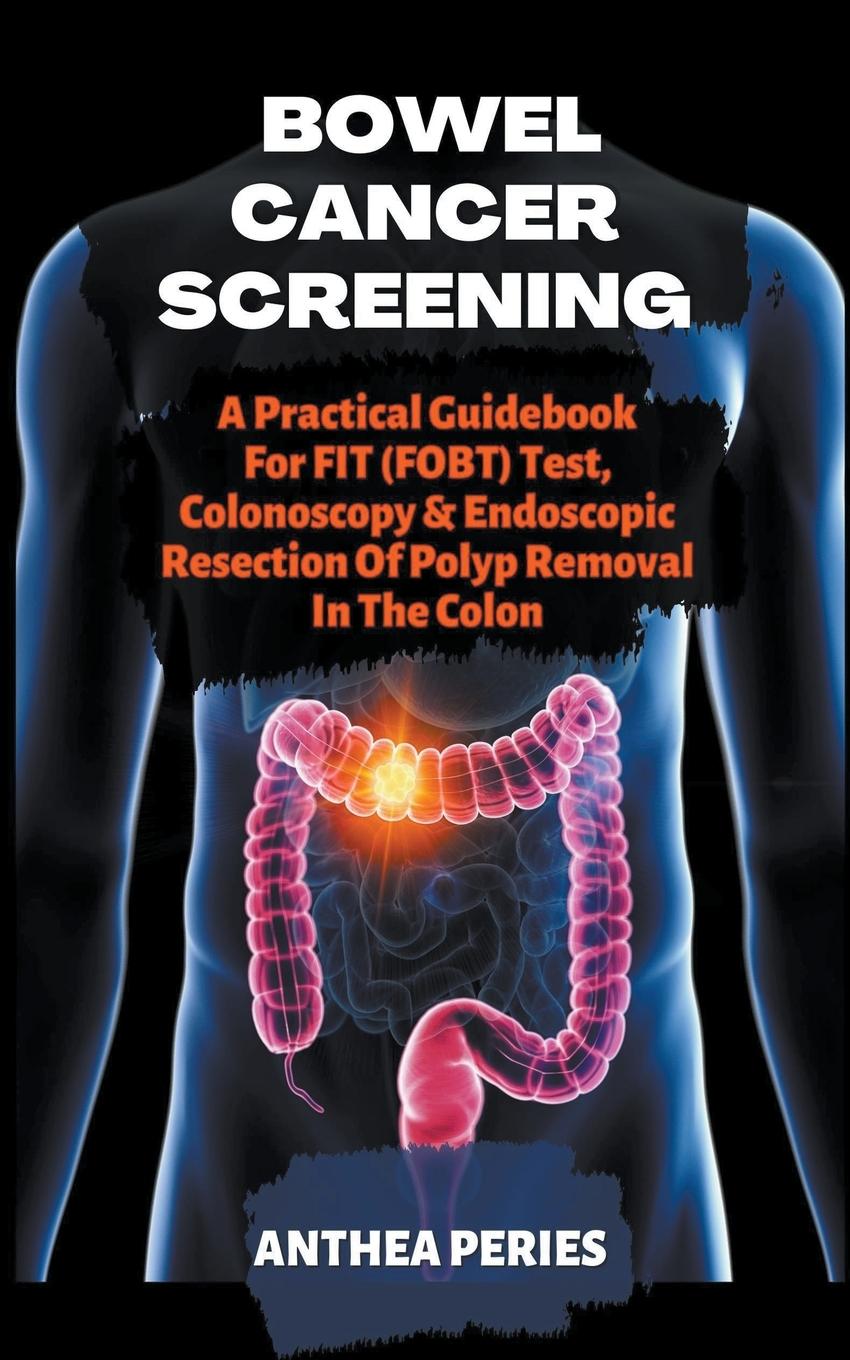 Könyv Bowel Cancer Screening 