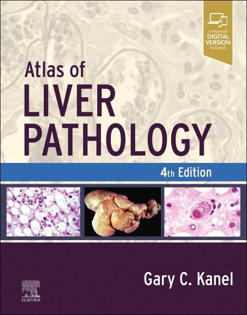 Carte Atlas of Liver Pathology Gary C. Kanel