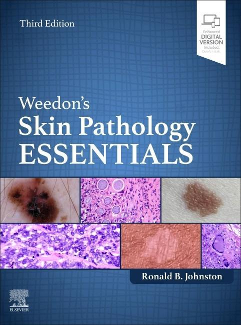 Carte Weedon's Skin Pathology Essentials Ronald Johnston