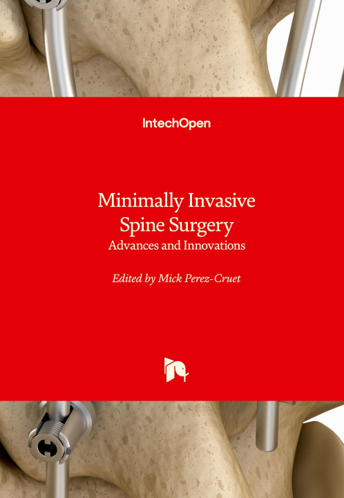 Kniha Minimally Invasive Spine Surgery 