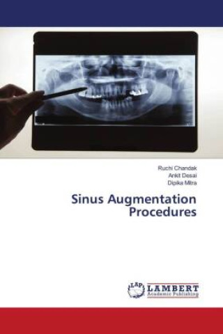 Kniha Sinus Augmentation Procedures Ankit Desai