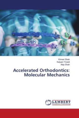 Knjiga Accelerated Orthodontics: Molecular Mechanics Kalyani Trivedi