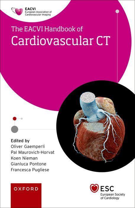 Kniha EACVI Handbook of Cardiovascular CT ál Maurovich-Horvat