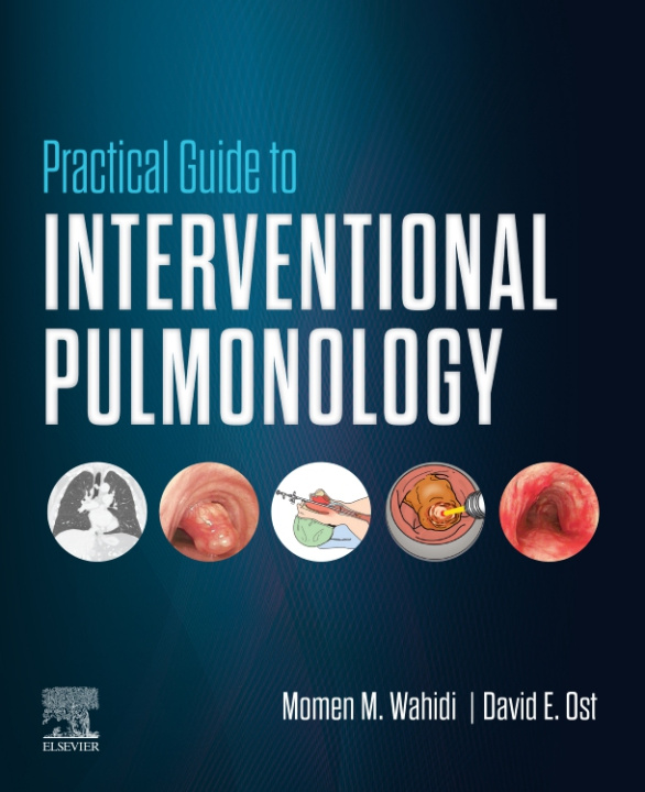 E-kniha Practical Guide to Interventional Pulmonology Momen M Wahidi
