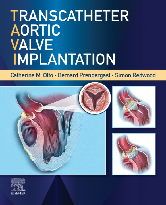 E-kniha Transcatheter Aortic Valve Implantation, E-Book Catherine M. Otto