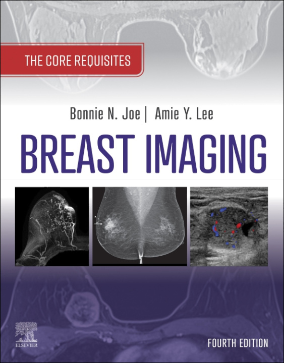 E-kniha Breast Imaging, E-Book Bonnie N. Joe