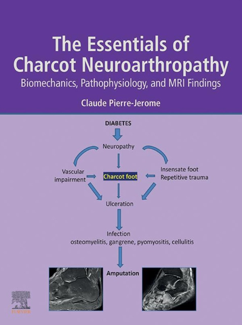 E-kniha Essentials of Charcot Neuroarthropathy Claude Pierre-Jerome