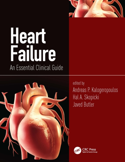 E-book Heart Failure Andreas P. Kalogeropoulos