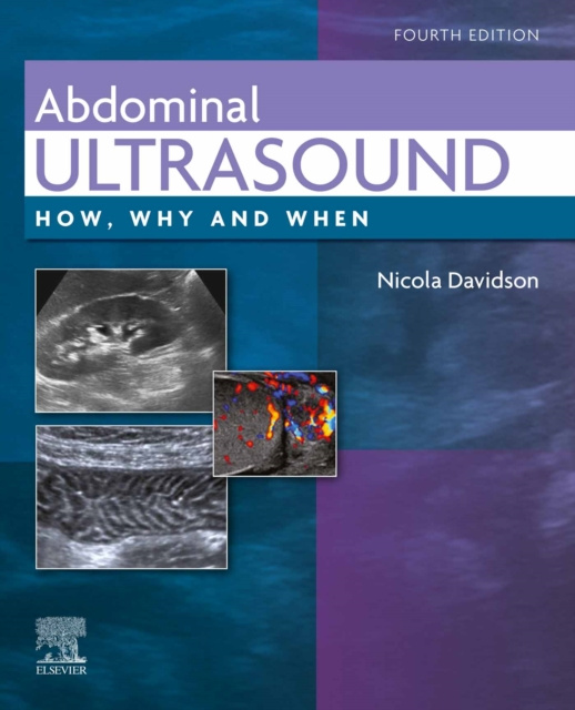E-kniha Abdominal Ultrasound E-Book Nicola Davidson