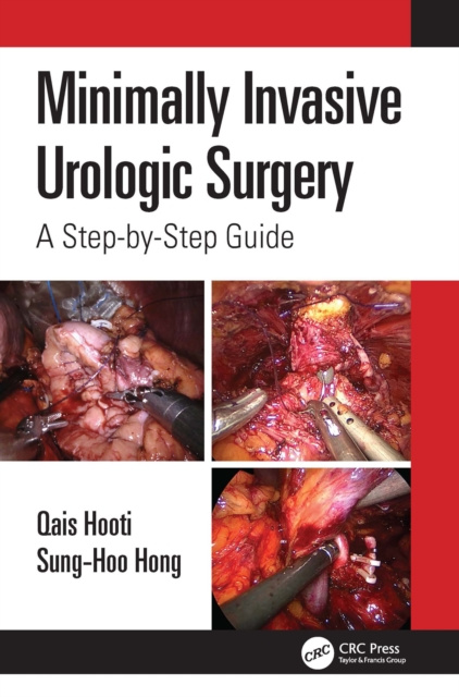 E-knjiga Minimally Invasive Urologic Surgery Qais Hooti
