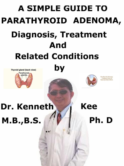 E-kniha Simple Guide to Parathyroid Adenoma, Diagnosis, Treatment and Related Conditions Kenneth Kee