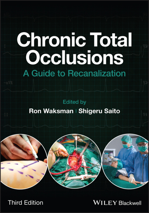 Carte Chronic Total Occlusions Shigeru Saito