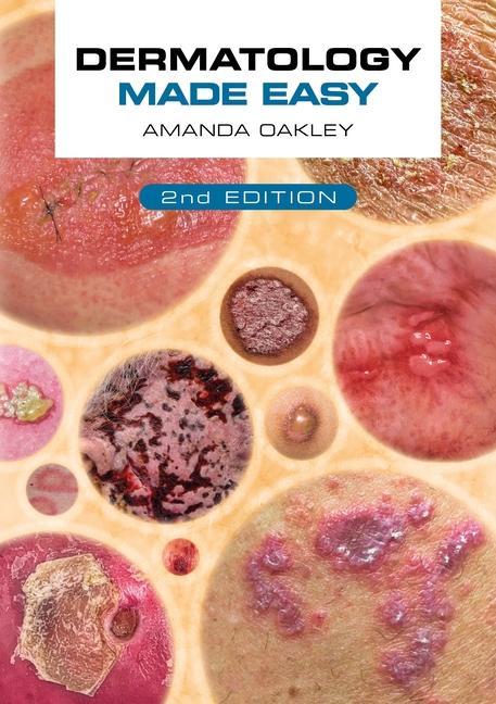 Książka Dermatology Made Easy, second edition Oakley