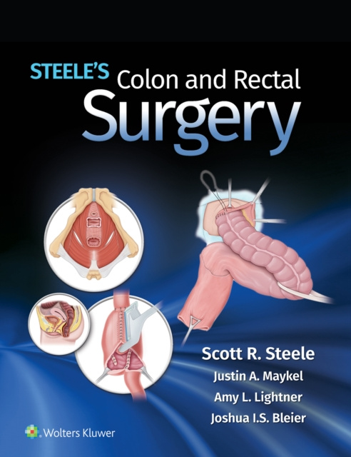 E-book Steele's Colon and Rectal Surgery Scott R. Steele