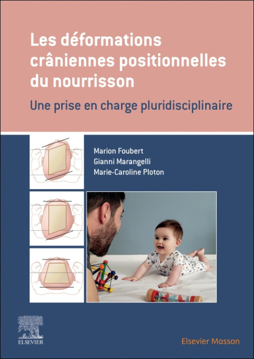 E-kniha Les deformations craniennes positionnelles du nourrisson Marion Foubert