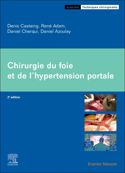 E-kniha Chirurgie du foie et de l'hypertension portale Denis Castaing