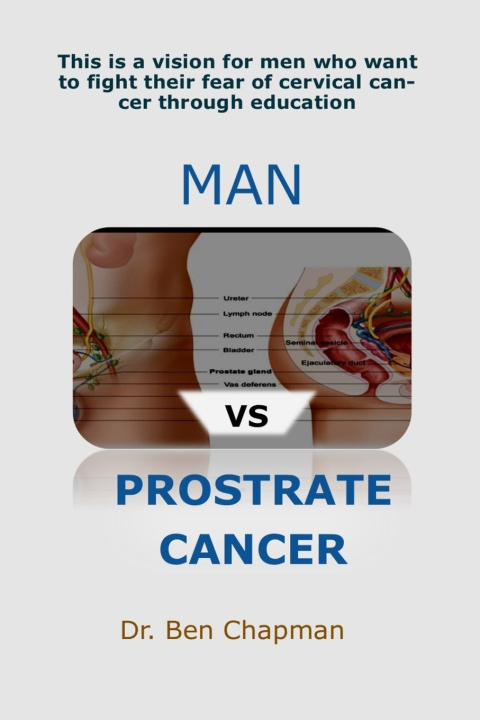 Kniha MAN Vs PROSTRATE CANCER Dr Ben Chapman