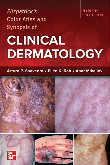 Книга Fitzpatrick's Color Atlas and Synopsis of Clinical Dermatology, Ninth Edition Ellen Roh