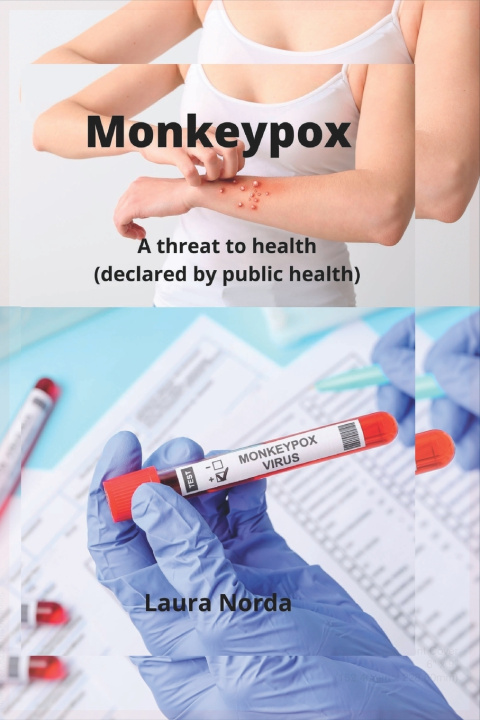 Knjiga MonkeyPox Laura Norda