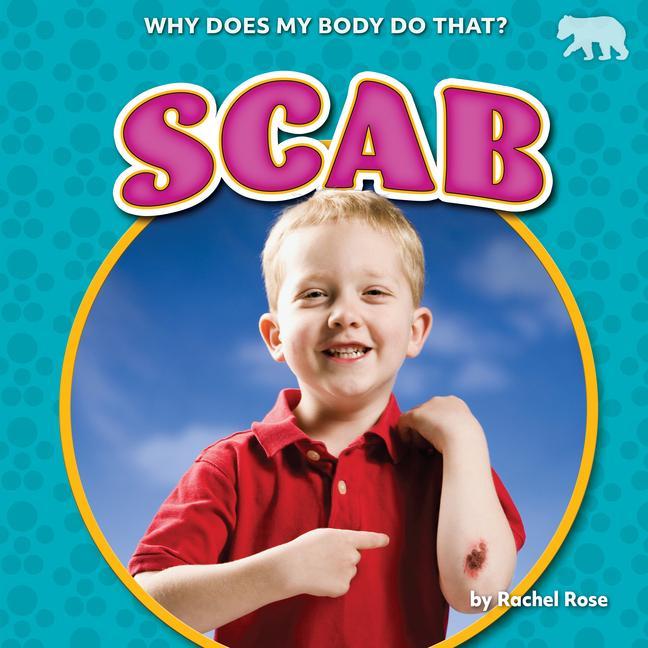 Knjiga Scab 