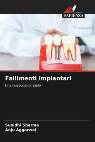 Book Fallimenti implantari Anju Aggarwal