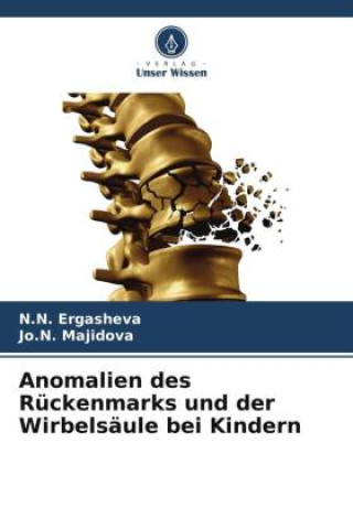 Kniha Anomalien des Rückenmarks und der Wirbelsäule bei Kindern Jo. N. Majidova