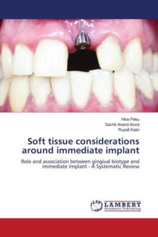 Carte Soft tissue considerations around immediate implant Sachit Anand Arora