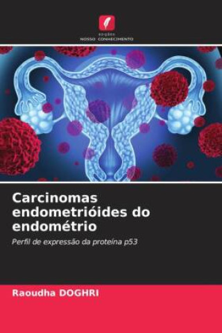 Knjiga Carcinomas endometrióides do endométrio Raoudha DOGHRI