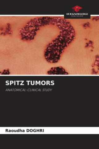 Knjiga SPITZ TUMORS Raoudha DOGHRI