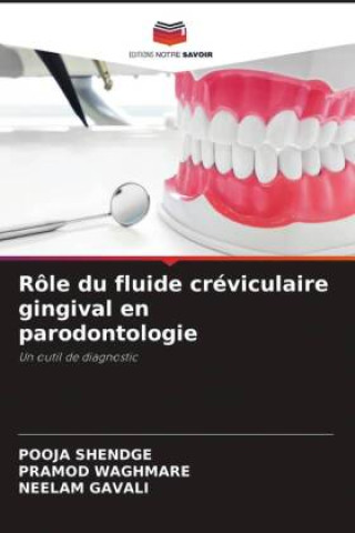 Kniha Rôle du fluide créviculaire gingival en parodontologie POOJA Shendge