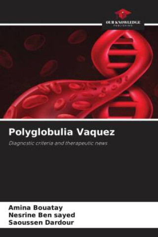 Knjiga Polyglobulia Vaquez Amina Bouatay