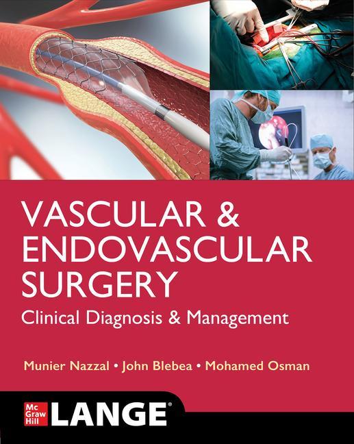 Könyv Lange Vascular and Endovascular Surgery: Clinical Diagnosis and Management John Blebea