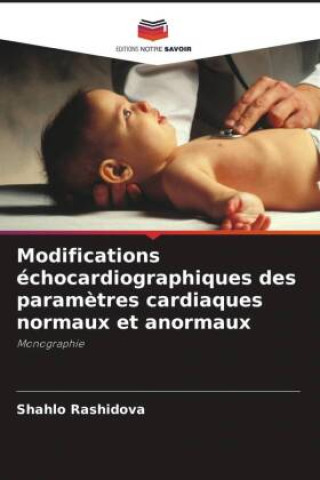 Knjiga Modifications échocardiographiques des param?tres cardiaques normaux et anormaux Shahlo Rashidova