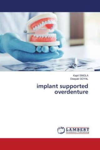Book implant supported overdenture Deepak Goyal