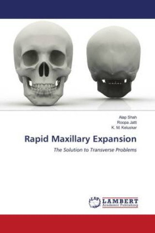 Kniha Rapid Maxillary Expansion Roopa Jatti