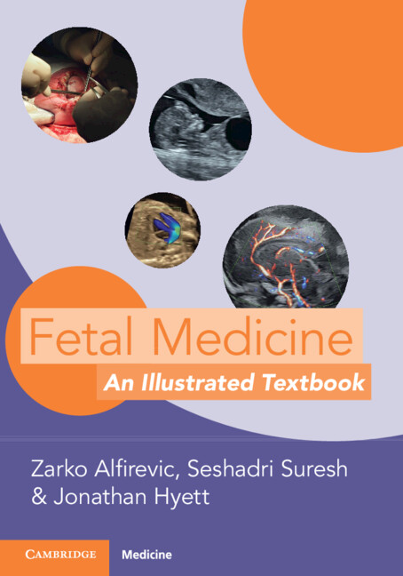Kniha Fetal Medicine Zarko Alfirevic