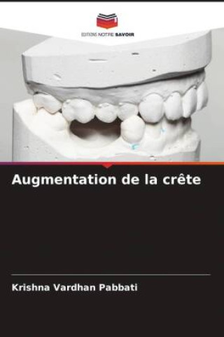 Knjiga Augmentation de la cr?te Krishna Vardhan Pabbati