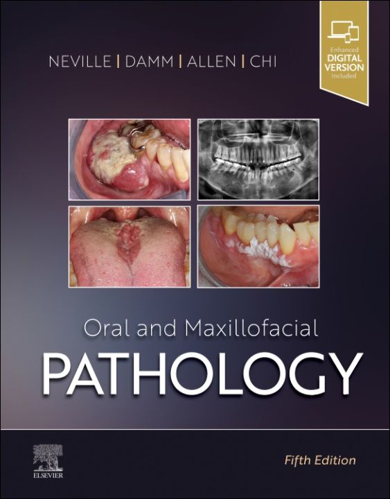 Książka Oral and Maxillofacial Pathology Brad W. Neville