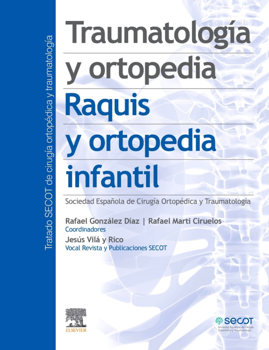 Kniha Traumatología y ortopedia. Raquis y ortopedia infantil 